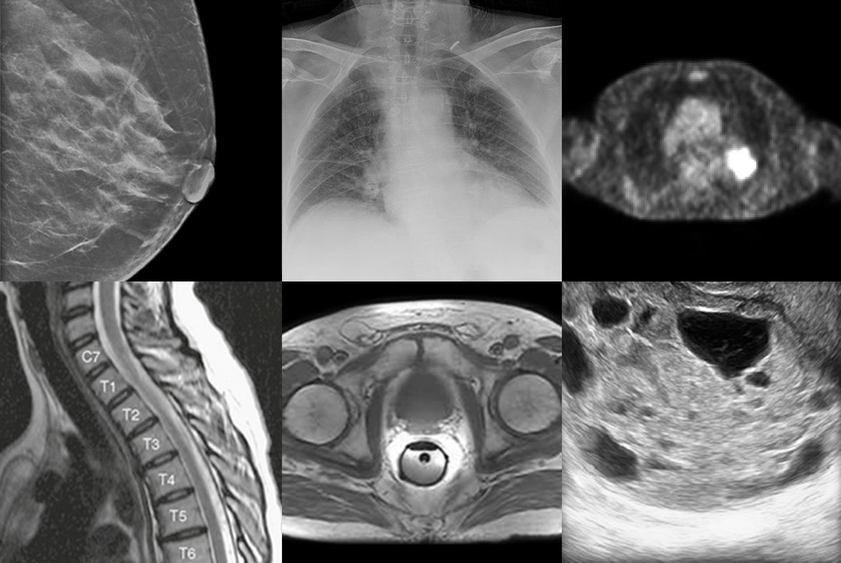 Image Analytics/Radiomics and AI-based tools for Research and Statistical Analyses